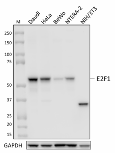 E2F1-KH95_PURE_E2F1_Antibody_1_110220.png