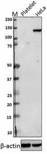 14A9C47_Purified_HDAC4_Antibody_WB_081417