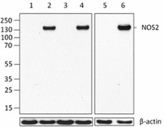 5C1B52_PURE_NOS2_Antibody_1_WB_092616