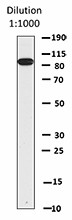 9C8B50_DBHRP_STAT5_Antibody_WB_062116
