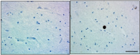 A15115A_HRP_alpha-synuclein_Antibody_2_042518