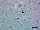 A17183A_HRP_alpha-Synuclein_1_101519.png