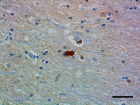 A17183A_HRP_alpha-Synuclein_3_101519.png