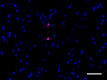 A17183A_Purified_alpha-Synuclein_3_123119