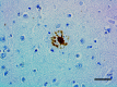 2_A18142A_PURE_beta-Amyloid_aggregated_Antibody_2_122619.png