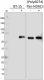 BT-15_Pure_HDAC1-phospho_Antibody_1_012319