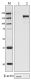 A_Ecoli_RNA_Polymerase_Kit_NT73_102017
