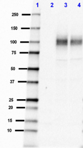 M3-2_PUREAF_beta-Amyloid_041018