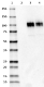 M3dot2_HRP_beta-amyloid_Antibody_1_041118