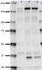 NMDA-Receptor_Antibody_Sampler_Kit_3_110318