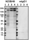 NMDA-Receptor_Antibody_Sampler_Kit_5_110318