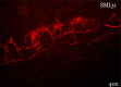 Neurofilament-LMH_Antibody_Sampler_Kit_4_110318