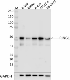 P88C12F4_PURE_RING1_Antibody_1_042820