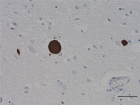 A_Syn204_Ascites_a-Synuclein_IHC_110918