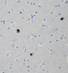 Syn303_Purified_a-synuclein_Antibody_IHC_021715