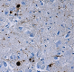 Syn515_PURE_Synuclein_alpha_Nitrated_Antibody_030519