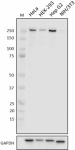 W19216A_PURE_Acetyl-CoA-Carboxylase_Antibody_110520.png