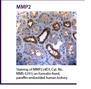 Staining of MMP2 (4D3, Cat. No. MMS-5291) on formalin-fixed, paraffin-embedded human kidney.