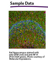 Rat hippocampus stained with anti-GFAP (red) and anti-NF-H (PCK-592P, green). Photo courtesy of Molecular Expressions.