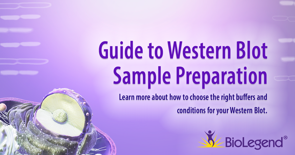 Guide To Western Blot Sample Preparation