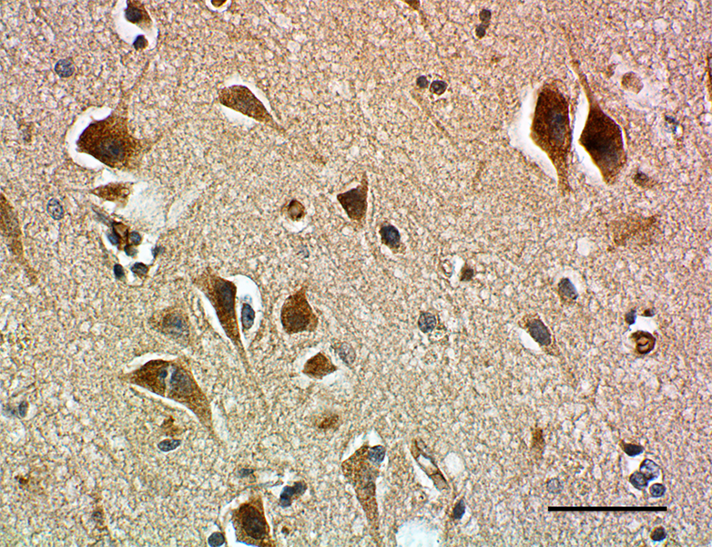 Data image: IHC staining of purified anti-Parkin antibody (clone A15165D) on formalin-fixed paraffin-embedded human brain tissue.